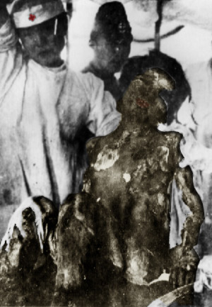 Manipoleret billede af en 14årig pige, der blev offer Hiroshima Atombomben